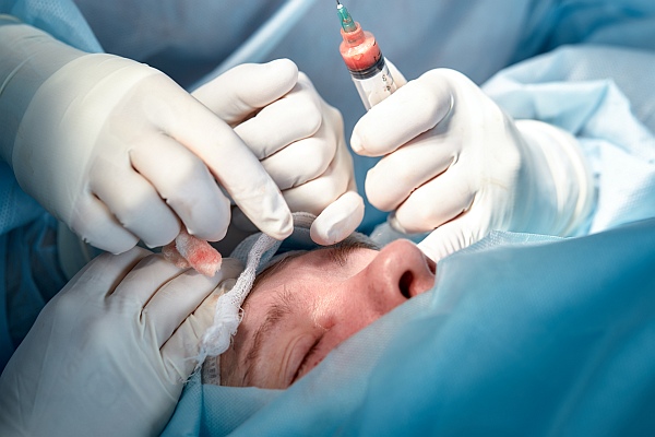 plastic surgery in a personal injury claim